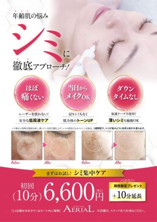 ［2Fエアリアル］痛くないシミ集中ケア！