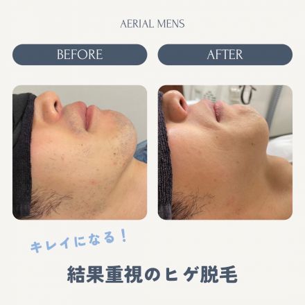 お盆限定キャンペーン