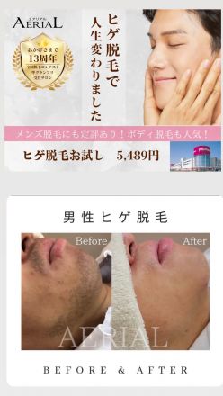 【エアリアル】脱毛グランプリ受賞記念！！