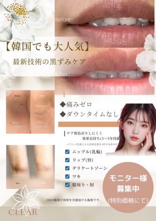 韓国で話題の黒ずみケア【CLEAR】八女初上陸！